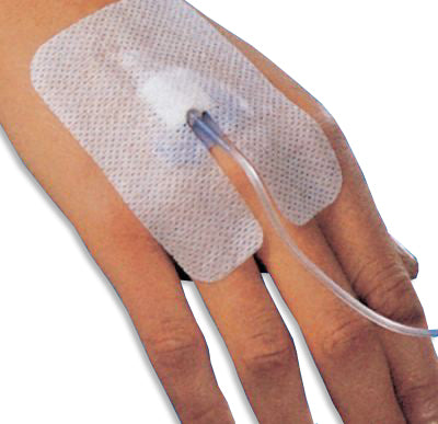 DISPOSITIVO DE FIXAÇÃO ADESIVA ESTÉRIL PARA CÂNULA